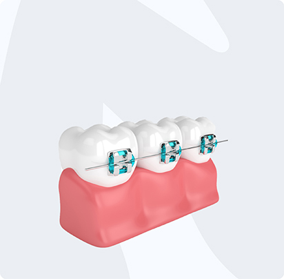 Ортодонтия в клинике Dentalka
